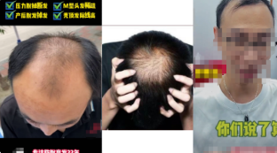 駁回原因示例： 請(qǐng)勿出現(xiàn)丑陋的影響用戶體驗(yàn)的元素，需重新設(shè)計(jì)廣告，如【視頻中展現(xiàn)禿頂、脫發(fā)脫毛形象】，請(qǐng)修改