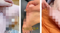 請勿使用皮膚干裂起皮、起屑、輕微干裂傷口等影響用戶體驗的素材設計，如【視頻中展現干裂起皮、起屑場景】，請修改