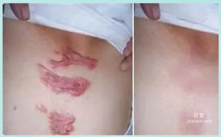 OPPO廣告素材不美觀