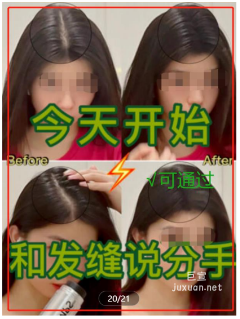 小紅書發(fā)際線粉廣告效果圖